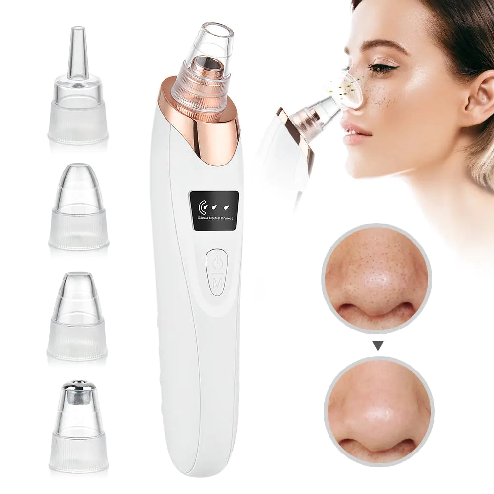 RadiantSkin Pro: Beauty Electric Blackhead Remover